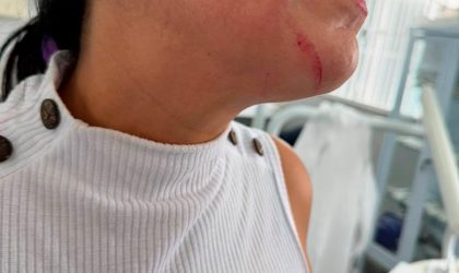 Posteriormente, a mesma paciente realizou ameaças de morte contra a profissional por meio de um áudio enviado a uma das técnicas da unidade.